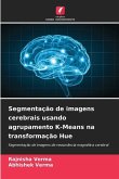 Segmentação de imagens cerebrais usando agrupamento K-Means na transformação Hue