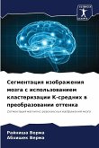 Segmentaciq izobrazheniq mozga s ispol'zowaniem klasterizacii K-srednih w preobrazowanii ottenka