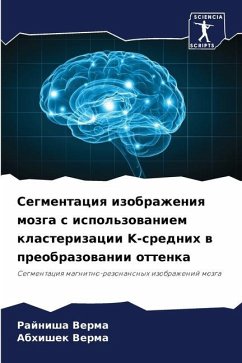 Segmentaciq izobrazheniq mozga s ispol'zowaniem klasterizacii K-srednih w preobrazowanii ottenka - Verma, Rajnisha;Verma, Abhishek