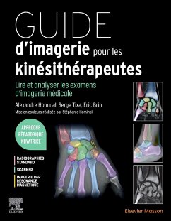 Guide d'Imagerie Pour Les Kinésithérapeutes - Hominal, Alexandre; Tixa, Serge; Brin, Eric