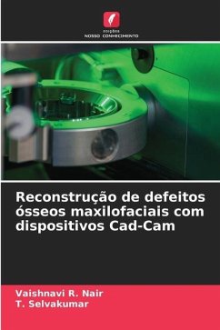 Reconstrução de defeitos ósseos maxilofaciais com dispositivos Cad-Cam - R. Nair, Vaishnavi;Selvakumar, T.