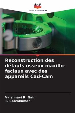 Reconstruction des défauts osseux maxillo-faciaux avec des appareils Cad-Cam - R. Nair, Vaishnavi;Selvakumar, T.