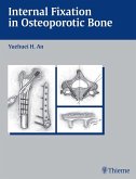 Internal Fixation in Osteoporotic Bone (eBook, ePUB)