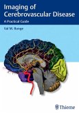 Imaging of Cerebrovascular Disease (eBook, ePUB)