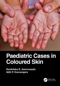 Cover Paediatric Cases in Coloured Skin (eBook, ePUB)