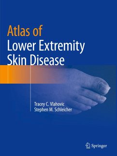 Atlas of Lower Extremity Skin Disease - Vlahovic, Tracey C.;Schleicher, Stephen M.