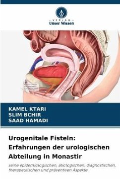 Urogenitale Fisteln: Erfahrungen der urologischen Abteilung in Monastir - Ktari, Kamel;BCHIR, SLIM;HAMADI, SAAD