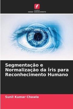 Segmentação e Normalização da Íris para Reconhecimento Humano - Chawla, Sunil Kumar