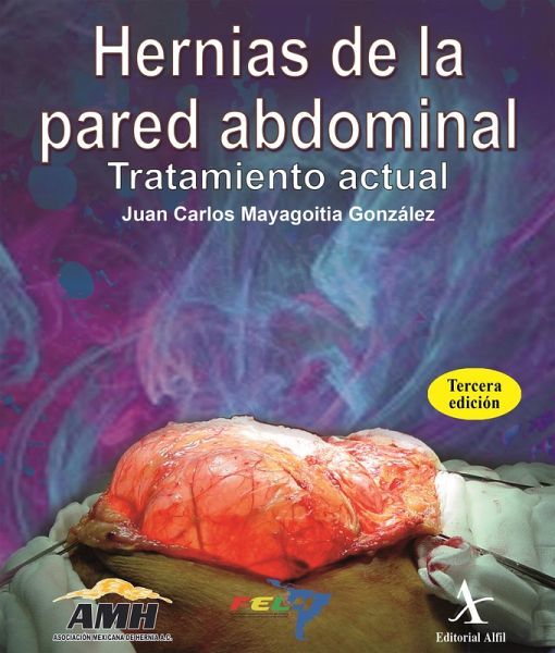Hernias de la pared abdominal (eBook, PDF)