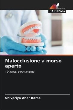 Malocclusione a morso aperto - Aher Borse, Shivpriya