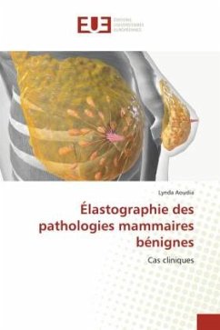 Élastographie des pathologies mammaires bénignes - Aoudia, Lynda