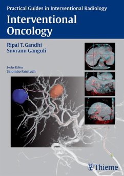 Cover Interventional Oncology (eBook, ePUB)