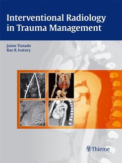 Interventional Radiology in Trauma Management (eBook, ePUB) - Tisnado, Jaime; Ivatury, Rao R