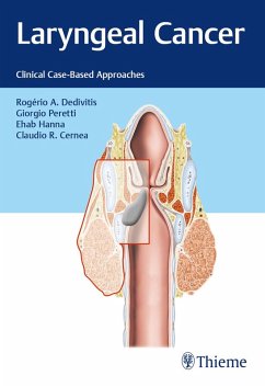 Laryngeal Cancer (eBook, ePUB) - Dedivitis, Rogério A.; Peretti, Giorgio; Hanna, Ehab Y.; Cernea, Claudio R.