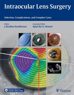 Cover Intraocular Lens Surgery (eBook, ePUB)