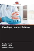 Moulage nasoalvéolaire