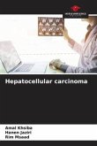 Hepatocellular carcinoma