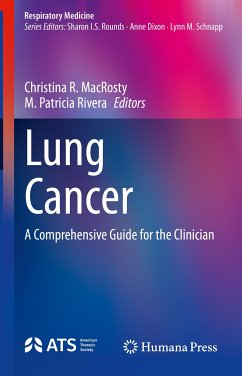 Lung Cancer (eBook, PDF)