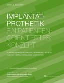 Implantatprothetik (eBook, ePUB)