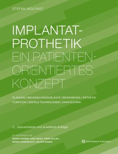 Implantatprothetik (eBook, ePUB) - Wolfart, Stefan