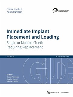 Immediate Implant Placement and Loading - Single or Multiple Teeth Requiring Replacement (eBook, ePUB) - Lambert, France; Hamilton, Adam