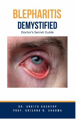 Blepharitis Demystified: Doctor's Secret Guide (eBook, ePUB) - Kashyap, Ankita; Sharma, Krishna N.