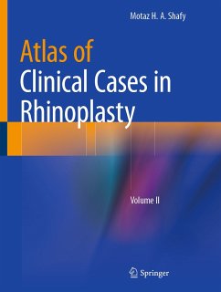 Atlas of Clinical Cases in Rhinoplasty (eBook, PDF) - Shafy, Motaz H. A.