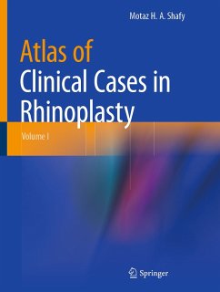 Atlas of Clinical Cases in Rhinoplasty (eBook, PDF) - Shafy, Motaz H. A.