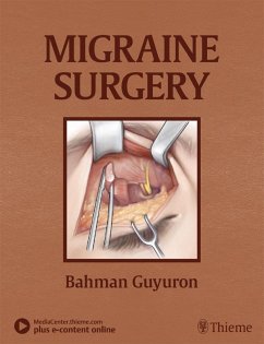 Cover Migraine Surgery (eBook, ePUB)