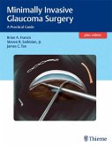 Minimally Invasive Glaucoma Surgery (eBook, ePUB)