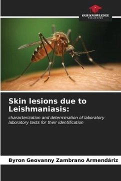 Skin lesions due to Leishmaniasis - Zambrano Armendáriz, Byron Geovanny