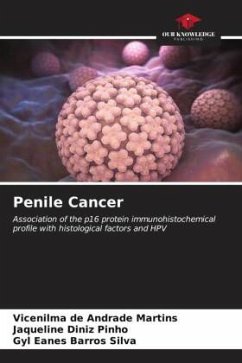 Penile Cancer - de Andrade Martins, Vicenilma;Diniz Pinho, Jaqueline;Barros Silva, Gyl Eanes