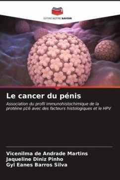 Le cancer du pénis - de Andrade Martins, Vicenilma;Diniz Pinho, Jaqueline;Barros Silva, Gyl Eanes