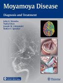 Moyamoya Disease (eBook, ePUB)