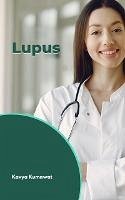 Cover Lupus (eBook, ePUB)