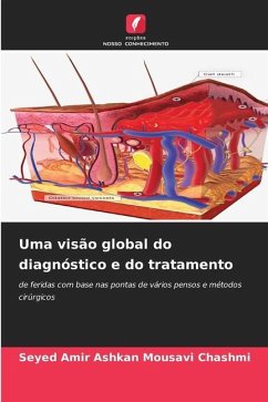 Uma visão global do diagnóstico e do tratamento - Chashmi, Seyed Amir Ashkan Mousavi