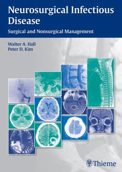 Cover Neurosurgical Infectious Disease (eBook, ePUB)