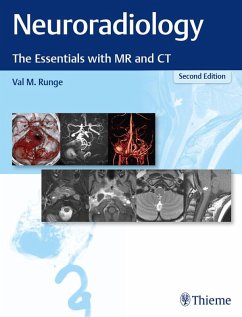 Cover Neuroradiology (eBook, ePUB)