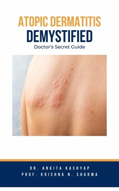 Atopic Dermatitis Demystified: Doctor's Secret Guide (eBook, ePUB) - Kashyap, Ankita; Sharma, Krishna N.