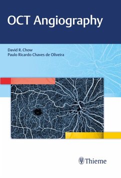 OCT Angiography (eBook, ePUB) - Chow, David