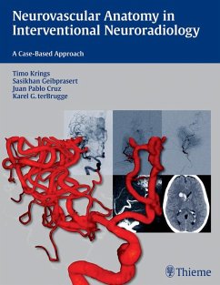 Neurovascular Anatomy in Interventional Neuroradiology (eBook, ePUB) - Krings, Timo; Geibprasert, Sasikhan; Cruz, Juan Pablo; Ter Brugge, Karel