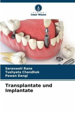 Transplantate und Implantate - Rana, Saraswati;Chandhok, Tushyata;Dangi, Pawan