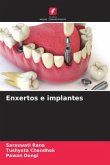 Enxertos e implantes