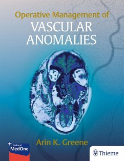 Operative Management of Vascular Anomalies (eBook, ePUB)