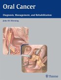 Oral Cancer (eBook, ePUB) Oral Cancer (eBook, ePUB)