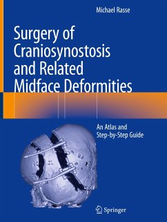 Surgery of Craniosynostosis and Related Midface Deformities - Rasse, Michael