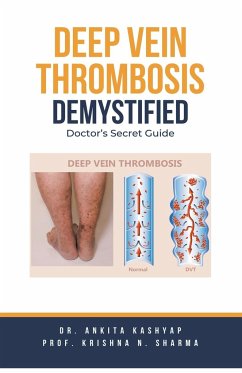 Deep Vein Thrombosis Demystified - Kashyap, Ankita; Sharma, Krishna N.