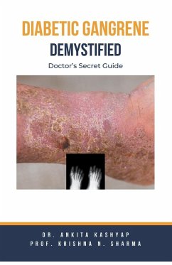 Cover Diabetic Gangrene Demystified