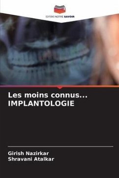 Les moins connus... IMPLANTOLOGIE - Nazirkar, Girish;Atalkar, Shravani