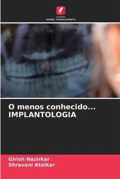 O menos conhecido... IMPLANTOLOGIA - Nazirkar, Girish;Atalkar, Shravani